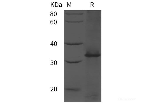 Recombinant Human IL7R/IL-7R/CD127 protein (His tag)