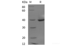 Recombinant Human LDHB protein (His tag)