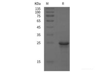 Recombinant Human CD147/BSG/Basigin protein (His tag)