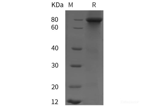 Recombinant Human RHOT2 protein (His tag)