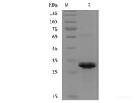 Recombinant Human RAB5B protein (His tag)