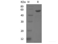 Recombinant Human PIK3R5 protein (His tag)