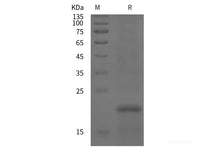 Recombinant Human ATXN7L1 protein (His tag)