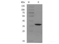 Recombinant Human PRRG4 protein (GST,His tag)