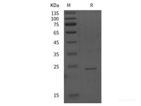 Recombinant Human PRRG3 protein (His tag)