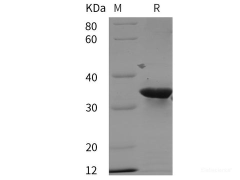 Recombinant Human PRRG2 protein (GST,His tag)