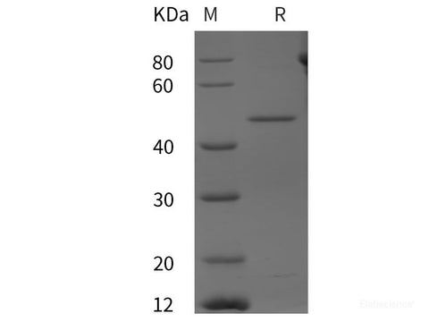 Recombinant Human CCNI/Cyclin-I protein (His tag)