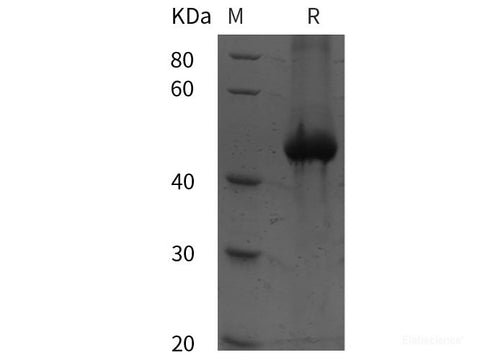 Recombinant Human Sperm-associated antigen 5/SPAG5 protein (His tag)