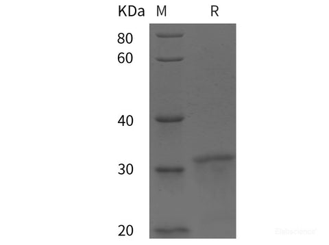 Recombinant Human SNAP25 protein (His tag)