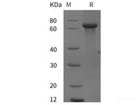 Recombinant Human SDHA protein (His tag)