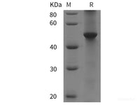 Recombinant Human RUNX3 protein (His tag)