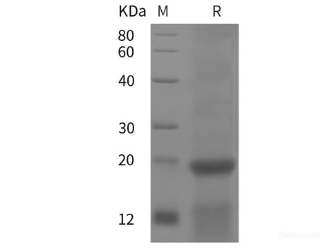 Recombinant Human Ribosomal Protein S25 protein (His tag)