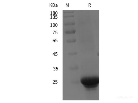 Recombinant Human RAB6A protein (His tag)