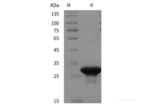 Recombinant Human RAB5C protein (His tag)