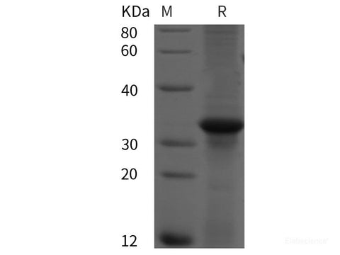 Recombinant Human RAB5A protein (His tag)