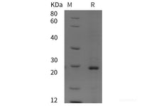 Recombinant Human RAB41 protein (His tag)