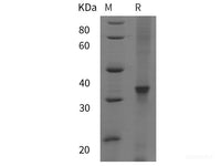 Recombinant Human PPARGC1B protein (His tag)