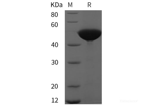 Recombinant Human PGD protein (His tag)