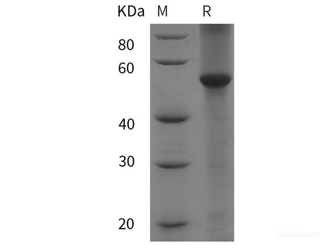 Recombinant Human PARP8 protein (His tag)