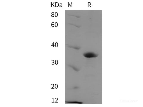 Recombinant Human PACT protein (His tag)