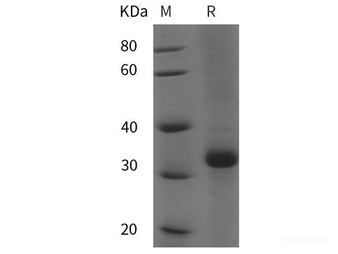 Recombinant Human LEPR/CD295 protein (His tag)