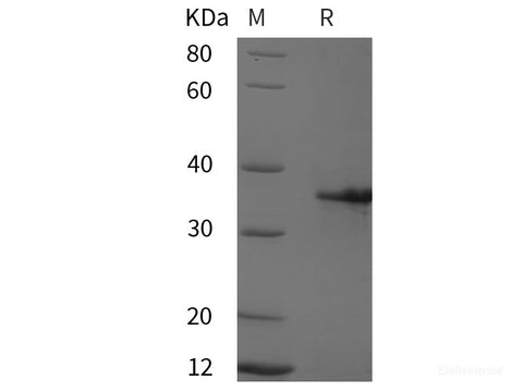 Recombinant Human MYOG/BHLHC3/MYF4 protein (His tag)