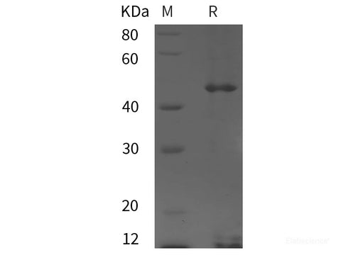 Recombinant Human TUBG2 protein (His tag)