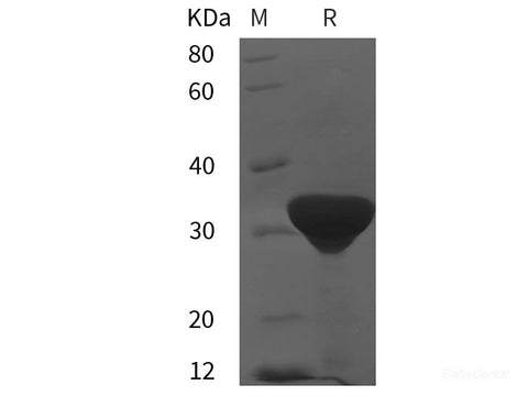 Recombinant Human Sas-6 protein (His tag)