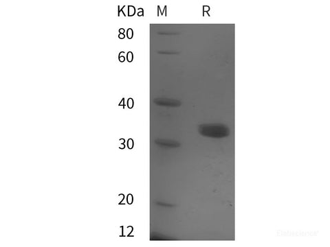 Recombinant Human MCM5 protein (His tag)