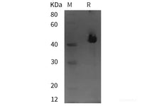 Recombinant Human MAPK9 protein (His tag)