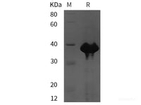 Recombinant Human SIRPalpha/CD172a protein (His tag)