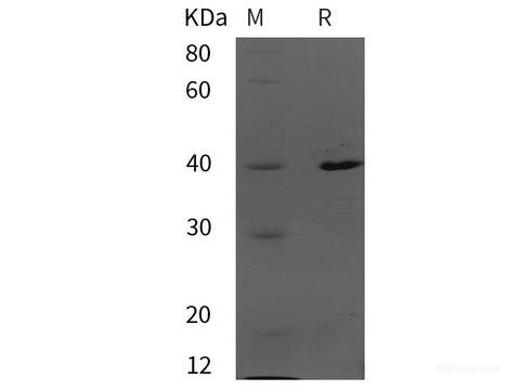 Recombinant Human MAPK12 protein (His tag)