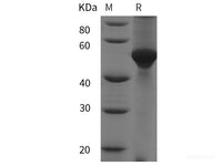 Recombinant Human LPL protein (His tag)