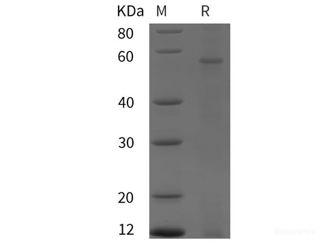 Recombinant Human hnRNPK protein (GST,His tag)