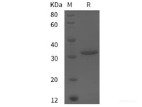 Recombinant Human Frizzled-7 protein (His tag)