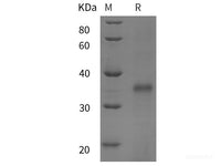 Recombinant Human FGFRL1 protein (His tag)