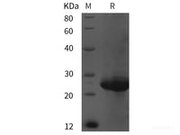 Recombinant Human FGFR1OP2 protein (His tag)