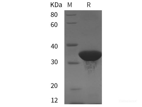 Recombinant Human FattyAcidSynthase protein (His tag)