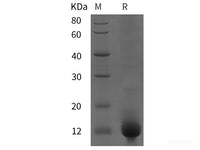 Recombinant Human CXCR5 protein (His tag)