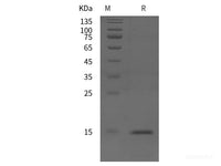 Recombinant Human AQP-2 protein (His tag)