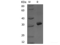 Recombinant Human ABCG2 protein (His tag)