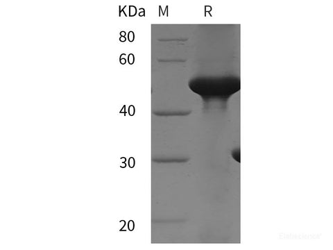 Recombinant Human SUOX protein (His tag)