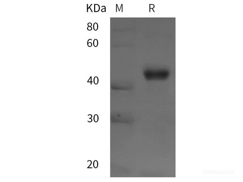 Recombinant Human PPM1A protein (His tag)