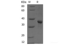 Recombinant Human PTCH1 protein (His tag)