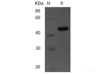 Recombinant Human OPTN protein (His tag)