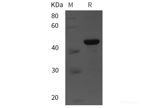 Recombinant Human OPTN protein (His tag)