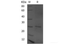 Recombinant Human AIMP2 protein (his tag)