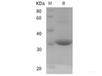 Recombinant Human UCP3 protein (SUMO,His tag)