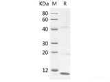 Recombinant Mouse S100A1 Protein (His Tag)(Active)