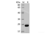 Recombinant Mouse IL-1 beta/IL1B Protein